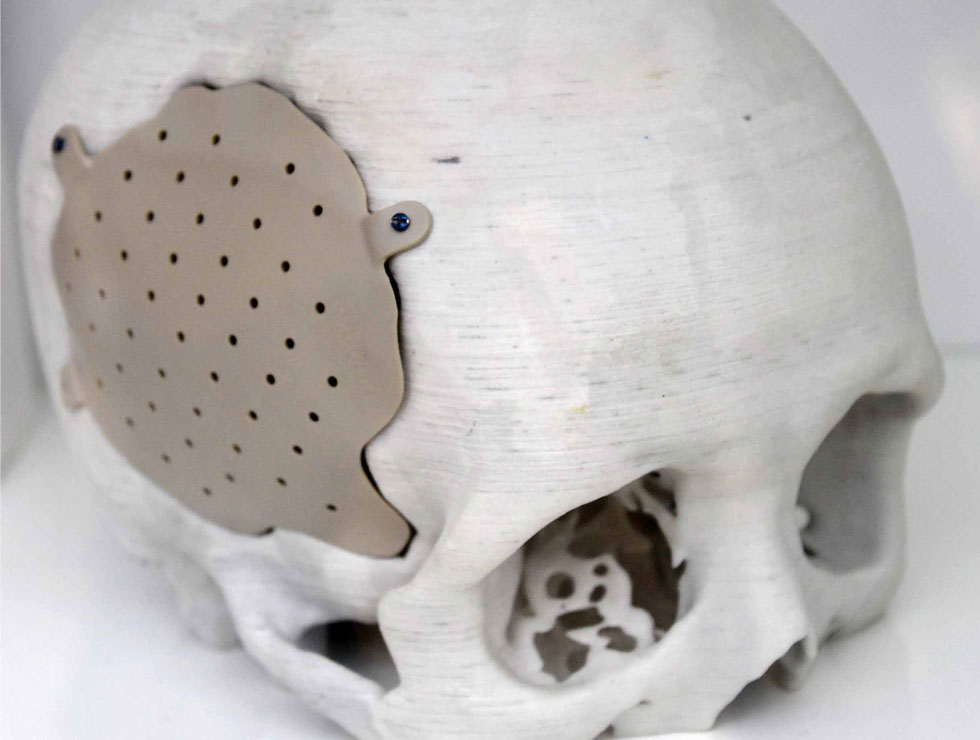 �@������ɫ�ĸ�ˎ��������Ŀ��������3D��ӡ���XĤ��